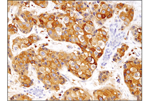 Immunohistochemistry Image 1: MTSS1 (D2H4L) Rabbit Monoclonal Antibody