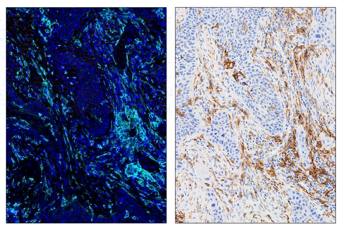 Immunohistochemistry Image 6: CD11c (D3V1E) & CO-0017-594 SignalStar<sup>™</sup> Oligo-Antibody Pair