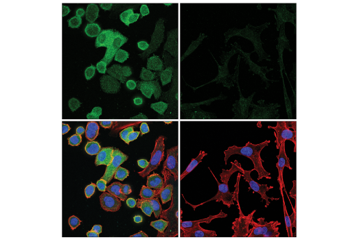 Immunofluorescence Image 1: Coronin 1A (D6K5B) Rabbit Monoclonal Antibody