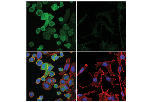 Immunofluorescence Image 1: Coronin 1A (D6K5B) XP<sup>®</sup> Rabbit mAb