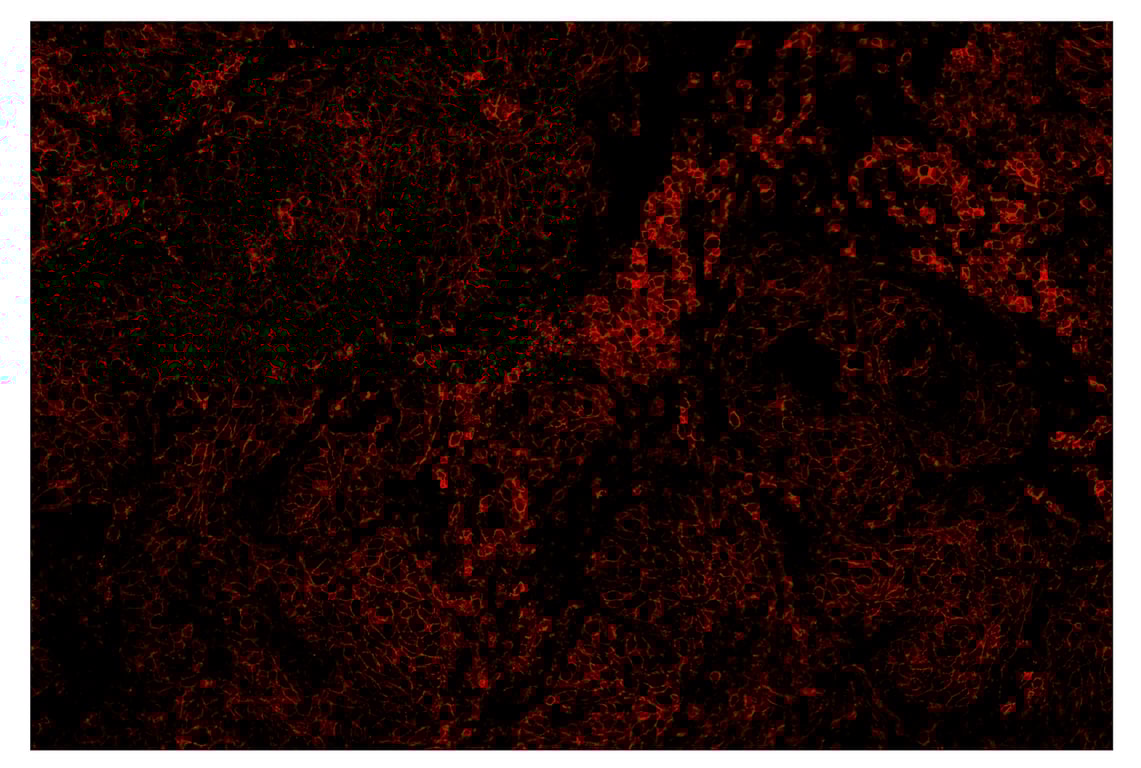 Immunohistochemistry Image 4: CD44 (E7K2Y) & CO-0030-594 SignalStar<sup>™</sup> Oligo-Antibody Pair