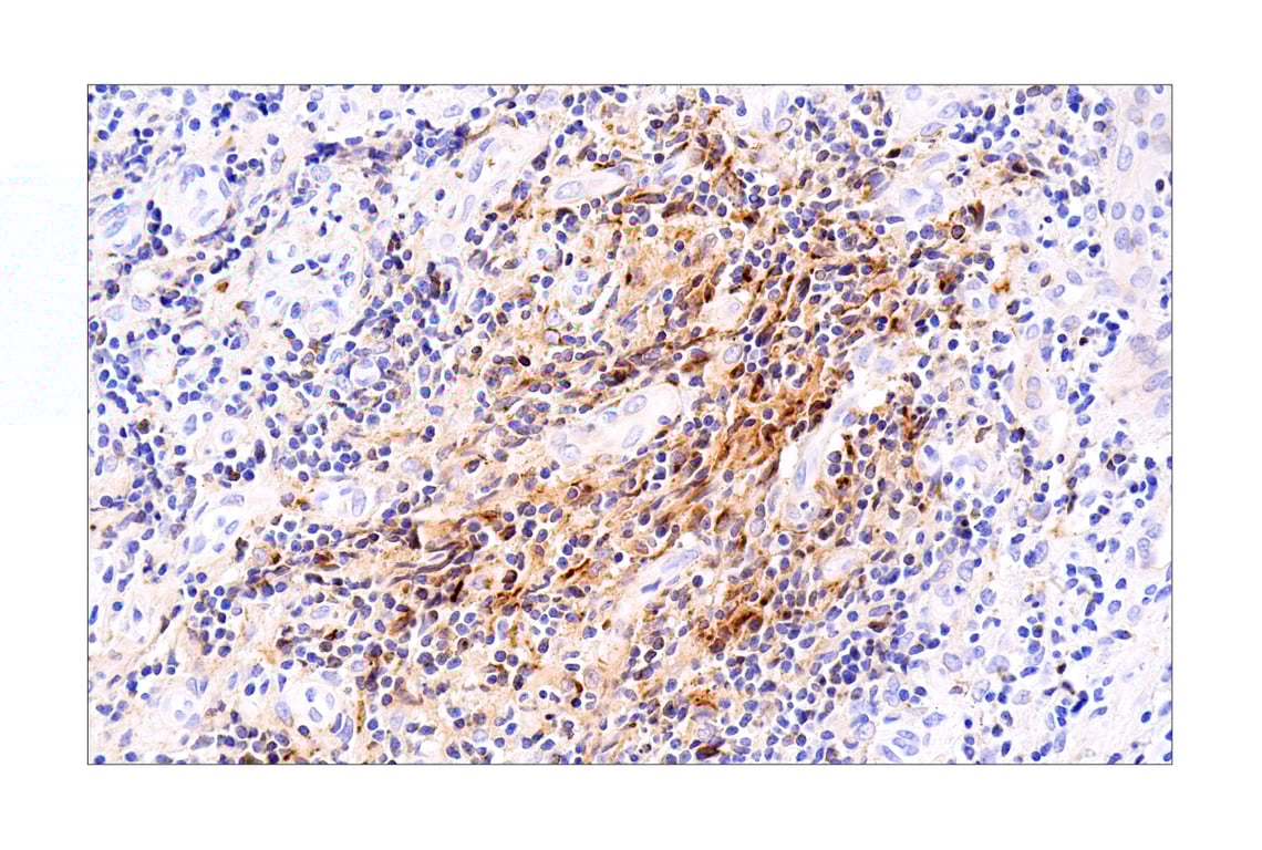 Immunohistochemistry Image 1: CXCL9/MIG (E6Z5W) Rabbit Monoclonal Antibody