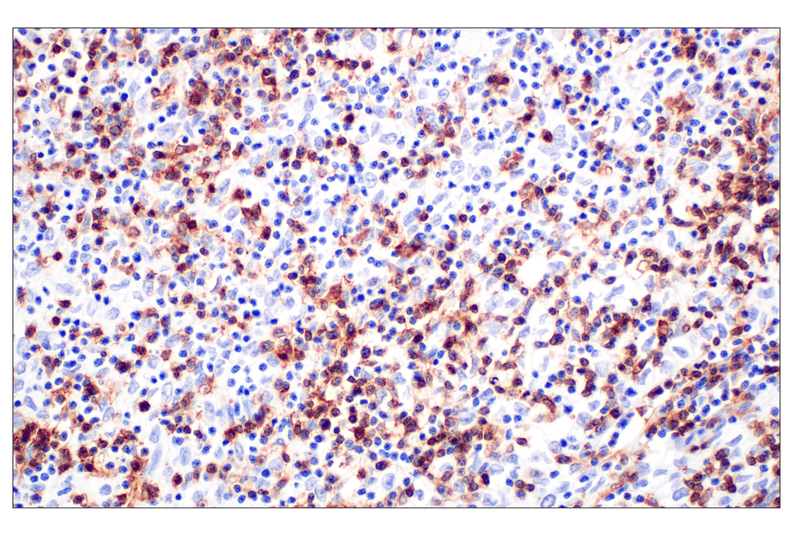 Immunohistochemistry Image 1: CD4 (MSVA-004R) Rabbit Monoclonal Antibody (BSA and Azide Free)