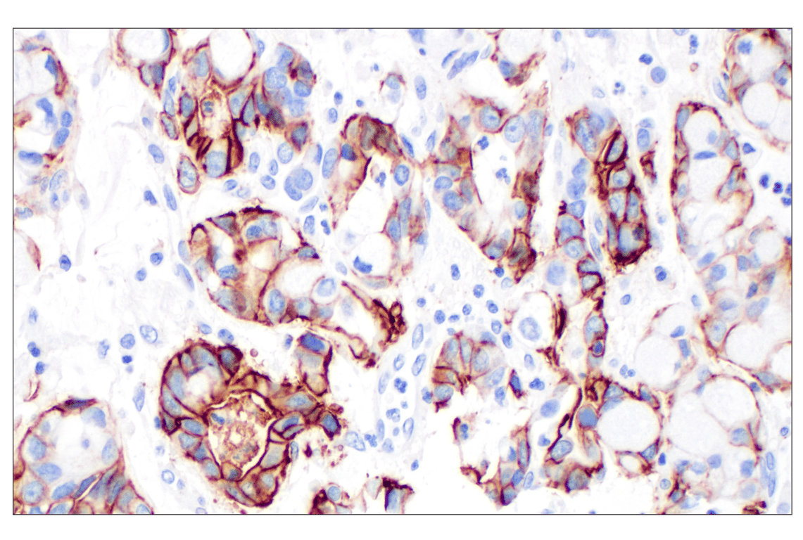 Immunohistochemistry Image 3: CD44 v6 (C44Mab-9) Mouse Monoclonal Antibody