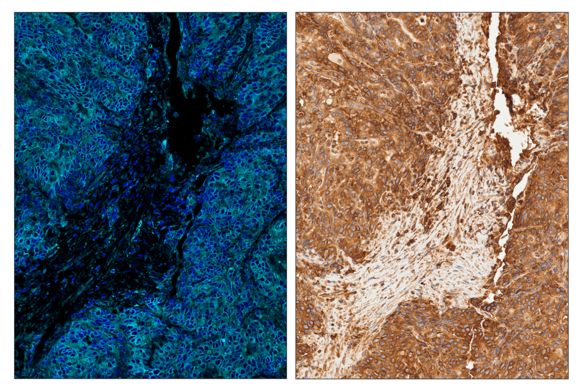 Immunohistochemistry Image 6: MHC Class I (EMR8-5) & CO-0082-647 SignalStar<sup>™</sup> Oligo-Antibody Pair