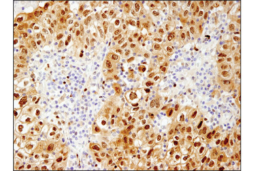 Immunohistochemistry Image 1: HSP70 (D1M6J) Mouse Monoclonal Antibody