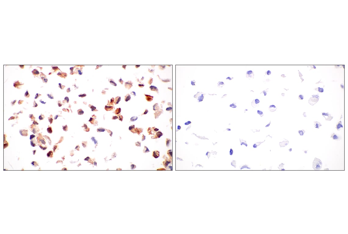 Immunohistochemistry Image 14: ARK5 (E4T2A) Rabbit Monoclonal Antibody