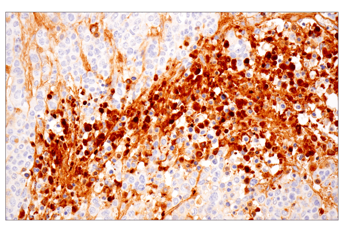 Immunohistochemistry Image 1: MMP-1 (E9S9N) Rabbit Monoclonal Antibody