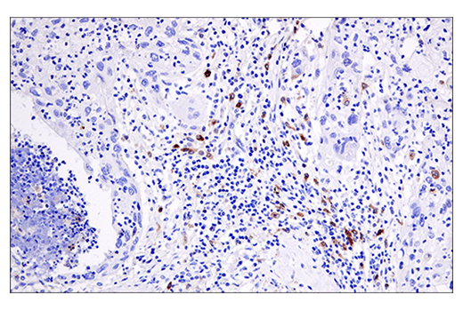 Immunohistochemistry Image 3: Cleaved Gasdermin D (Asp275) (E7H9G) Rabbit Monoclonal Antibody (BSA and Azide Free)