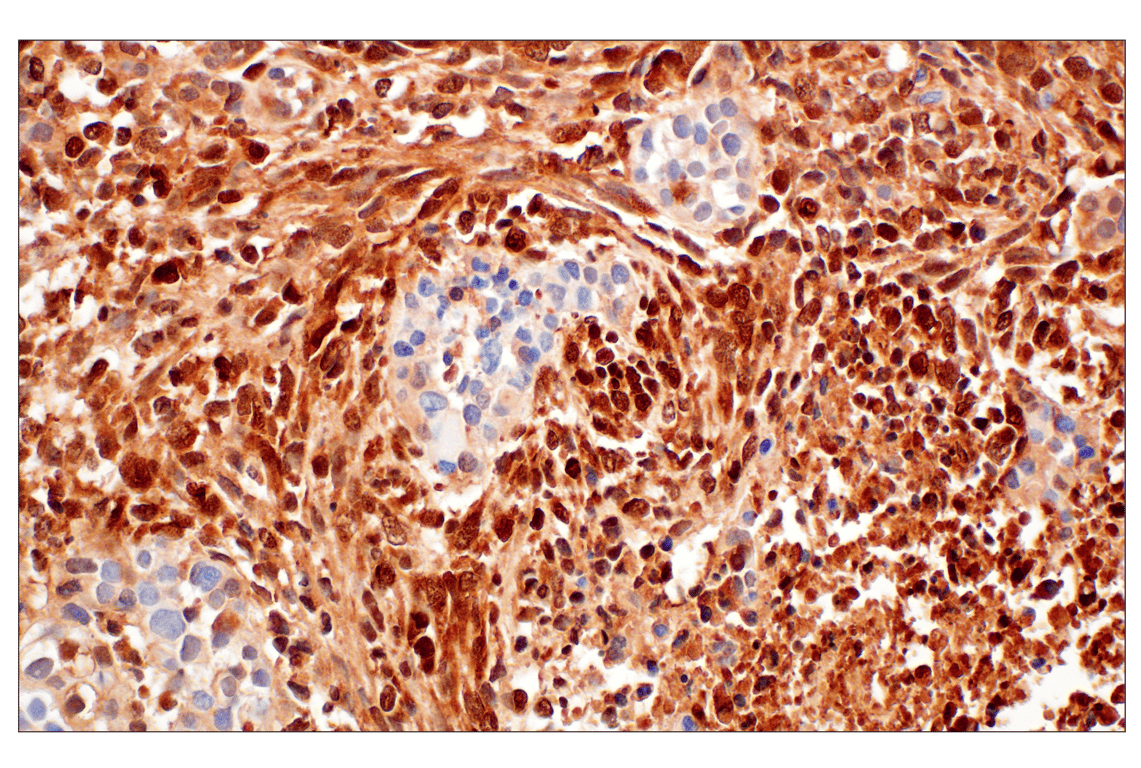 Immunohistochemistry Image 3: p16 INK4A (F9T1L) Rabbit Monoclonal Antibody