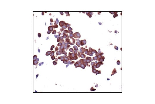 Immunohistochemistry Image 3: S6 Ribosomal Protein (54D2) Mouse Monoclonal Antibody