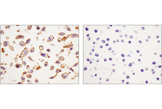 Immunohistochemistry Image 3: Catenin delta-1 (D7S2M) Rabbit Monoclonal Antibody
