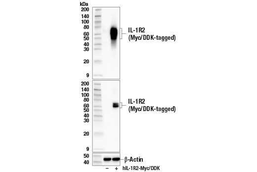 Western Blotting Image 2: IL-1R2 (E3K3O) Rabbit Monoclonal Antibody