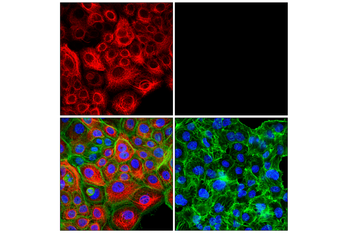 Immunofluorescence Image 1: Keratin 5 (E2T4B) Rabbit Monoclonal Antibody (Alexa Fluor<sup>®</sup> 647 Conjugate)