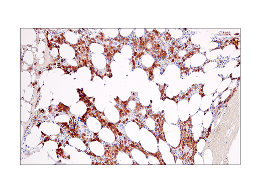 Immunohistochemistry Image 5: CRACC/SLAMF7/CD319 (E5C4M) Rabbit Monoclonal Antibody (BSA and Azide Free)