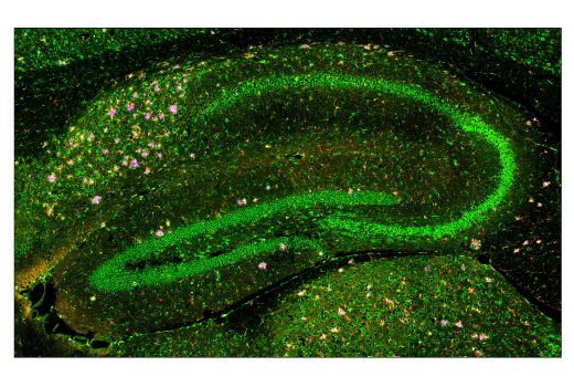 Immunofluorescence Image 2: Cathepsin D (E7Z4L) Rabbit Monoclonal Antibody (BSA and Azide Free)