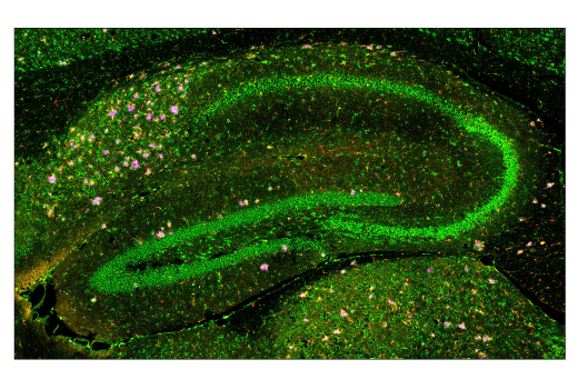 Immunofluorescence Image 2: Cathepsin D (E7Z4L) XP<sup>®</sup> Rabbit mAb (BSA and Azide Free)