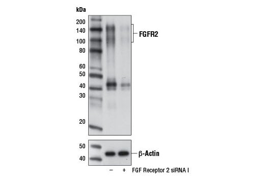 Western Blotting Image 2: FGF Receptor 2 (D4H9) Rabbit Monoclonal Antibody