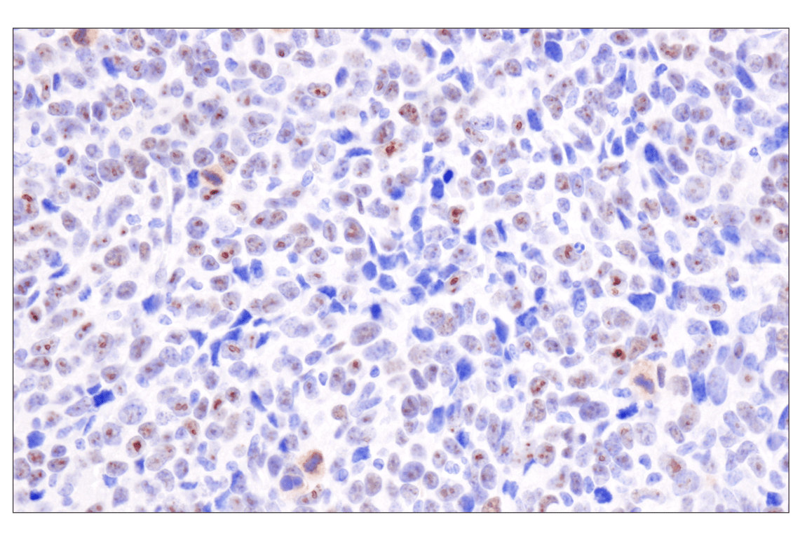 Immunohistochemistry Image 7: ADAR2 (F6U8S) Rabbit Monoclonal Antibody
