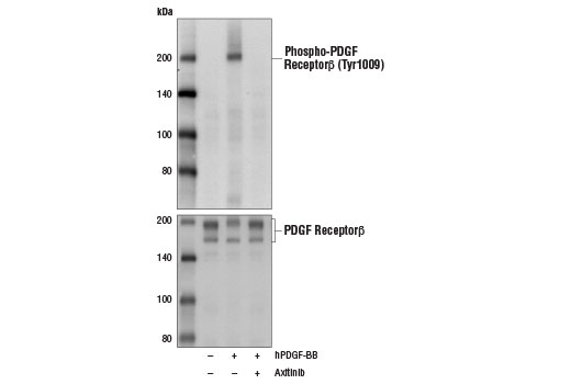 undefined Image 2: Axitinib