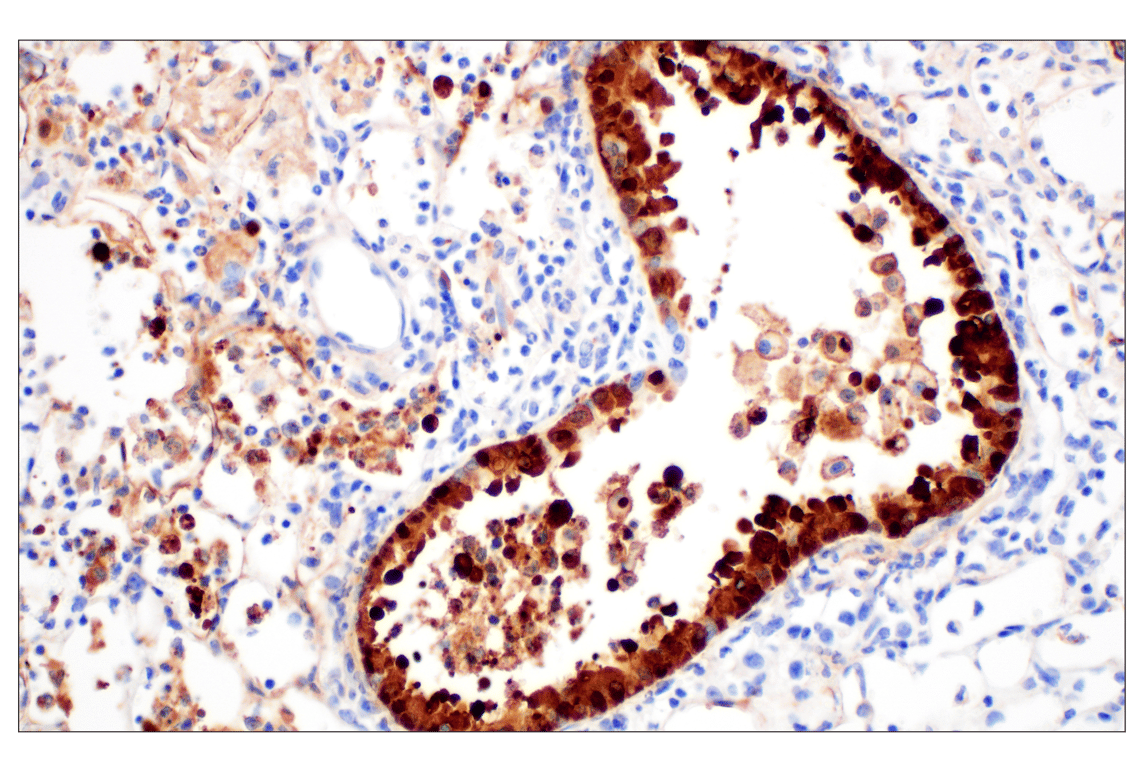 Immunohistochemistry Image 1: Influenza A Nucleoprotein (NP) (F8L6X) Rabbit Monoclonal Antibody