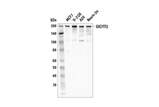 Western Blotting Image 2: GIGYF2 (E7F7I) Rabbit Monoclonal Antibody
