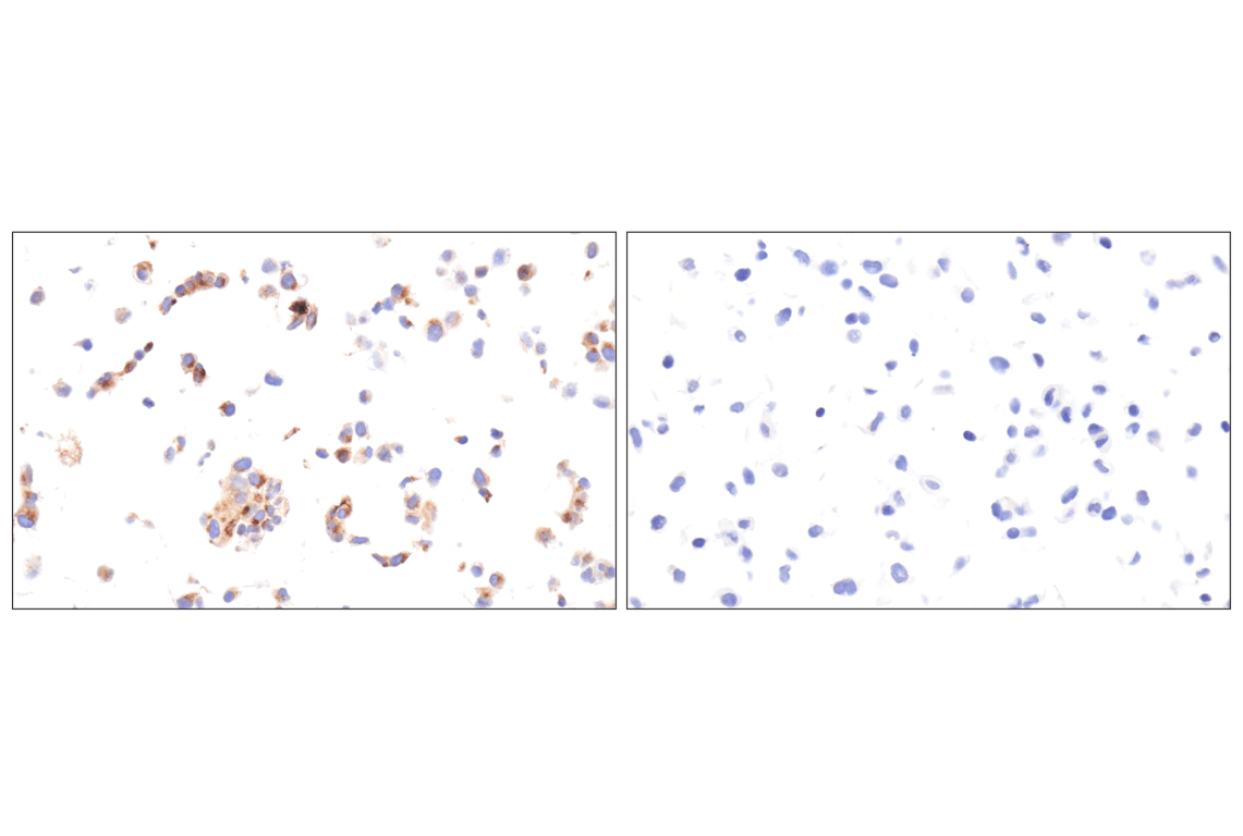Immunohistochemistry Image 15: Vitronectin (F8D3L) Rabbit Monoclonal Antibody