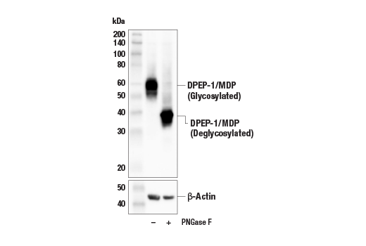 Western Blotting Image 2: DPEP-1/MDP (E4O6J) Rabbit Monoclonal Antibody
