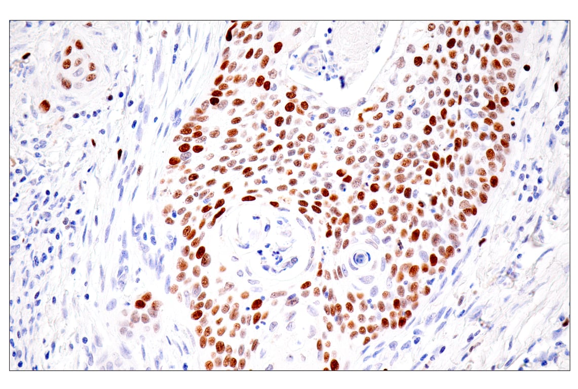 Immunohistochemistry Image 2: UHRF1 (E5W8W) Rabbit Monoclonal Antibody