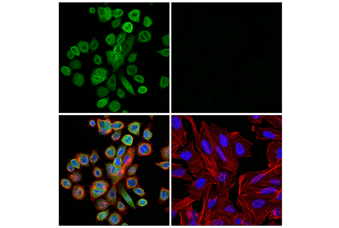 Immunofluorescence Image 1: UNC93B1 (E5H3O) Rabbit Monoclonal Antibody