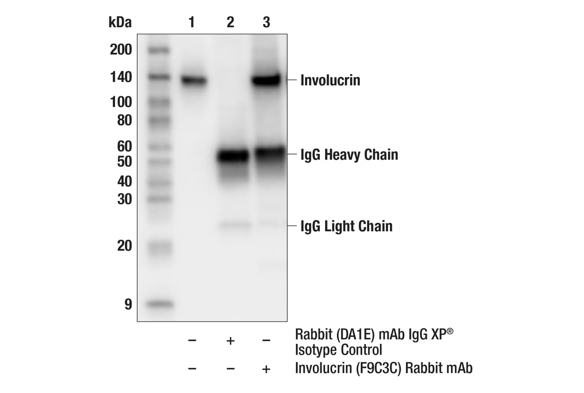 Immunoprecipitation Image 1: Involucrin (F9C3C) Rabbit Monoclonal Antibody