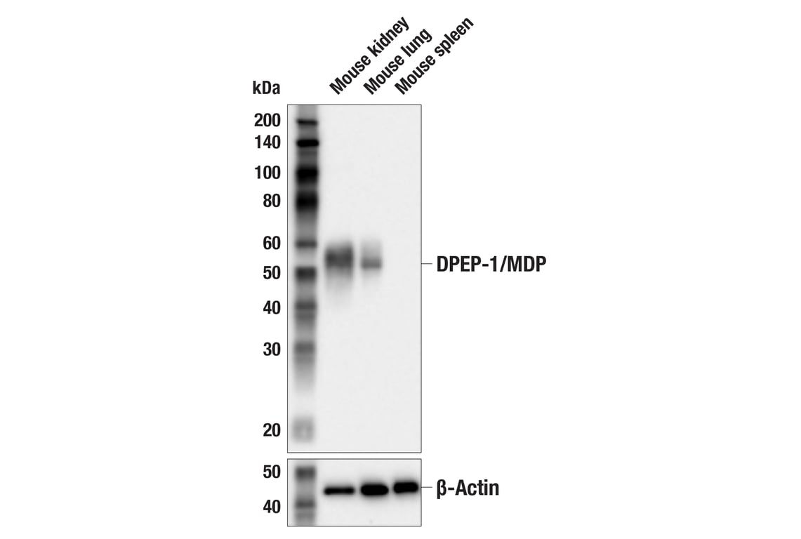 Western Blotting Image 2: DPEP-1/MDP (E5H7T) Rabbit Monoclonal Antibody
