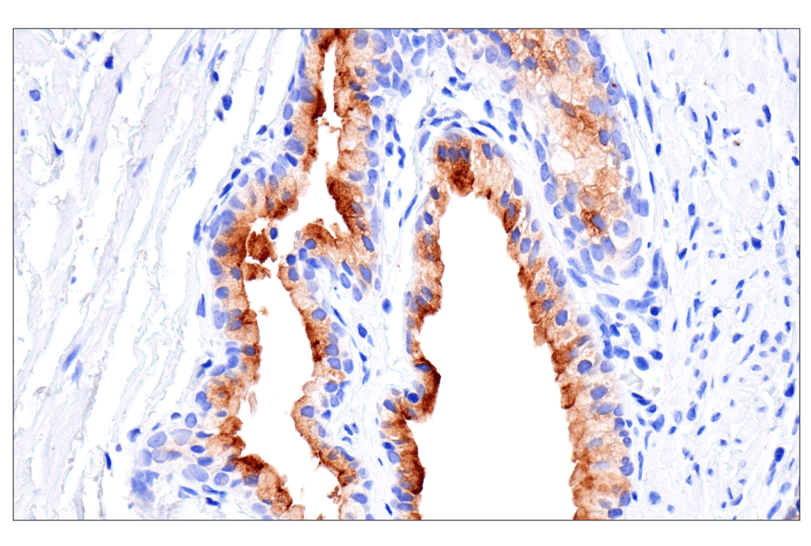 Immunohistochemistry Image 3: CD177 (F9O5U) Rabbit Monoclonal Antibody (BSA and Azide Free)