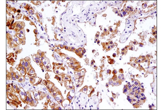 Immunohistochemistry Image 2: LSR (D3E3N) Rabbit Monoclonal Antibody