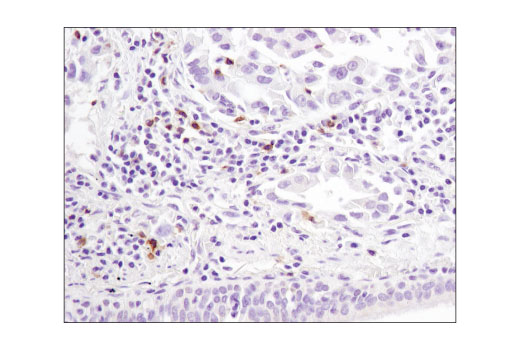 Immunohistochemistry Image 3: GITR (D9I9D) Rabbit Monoclonal Antibody