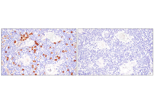 Immunohistochemistry Image 4: IL3RA/CD123 (BR4MS) Mouse Monoclonal Antibody