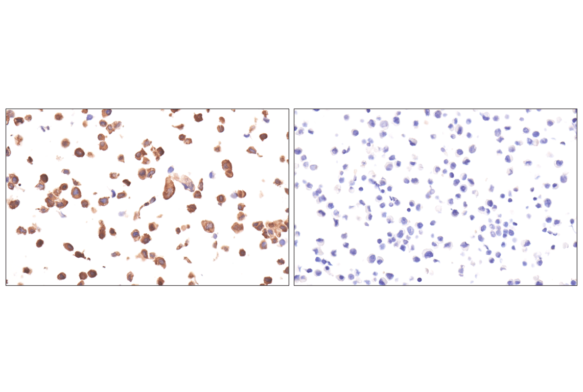 Immunohistochemistry Image 12: FAK (F7Z4C) Mouse Monoclonal Antibody