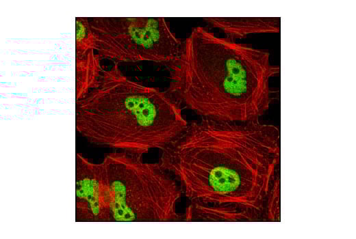 Immunofluorescence Image 1: G9a/EHMT2 (C6H3) Rabbit Monoclonal Antibody