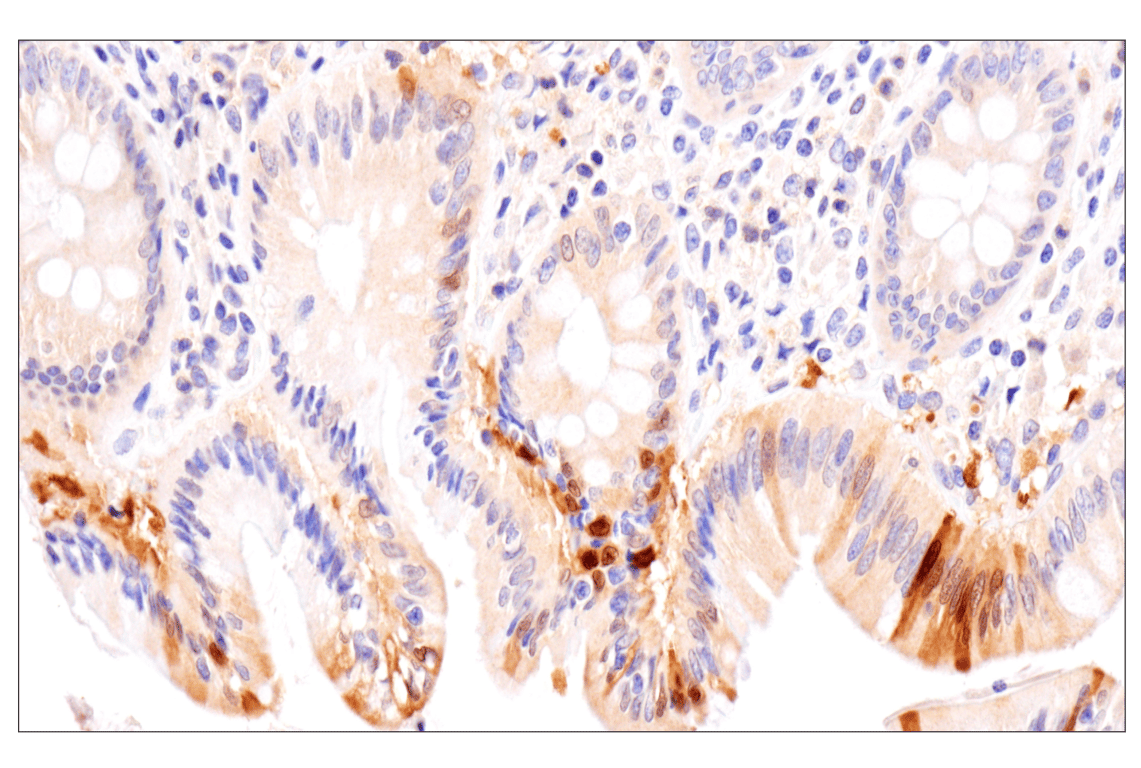 Immunohistochemistry Image 5: APOBEC3A (UMN-13) Rabbit Monoclonal Antibody (BSA and Azide Free)