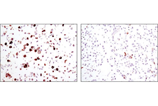 Immunohistochemistry Image 2: Phospho-S6 Ribosomal Protein (Ser240/244) (D68F8) Rabbit Monoclonal Antibody (BSA and Azide Free)