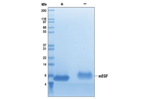 undefined Image 2: Mouse Epidermal Growth Factor (mEGF)