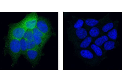 undefined Image 16: Actin Reorganization Antibody Sampler Kit