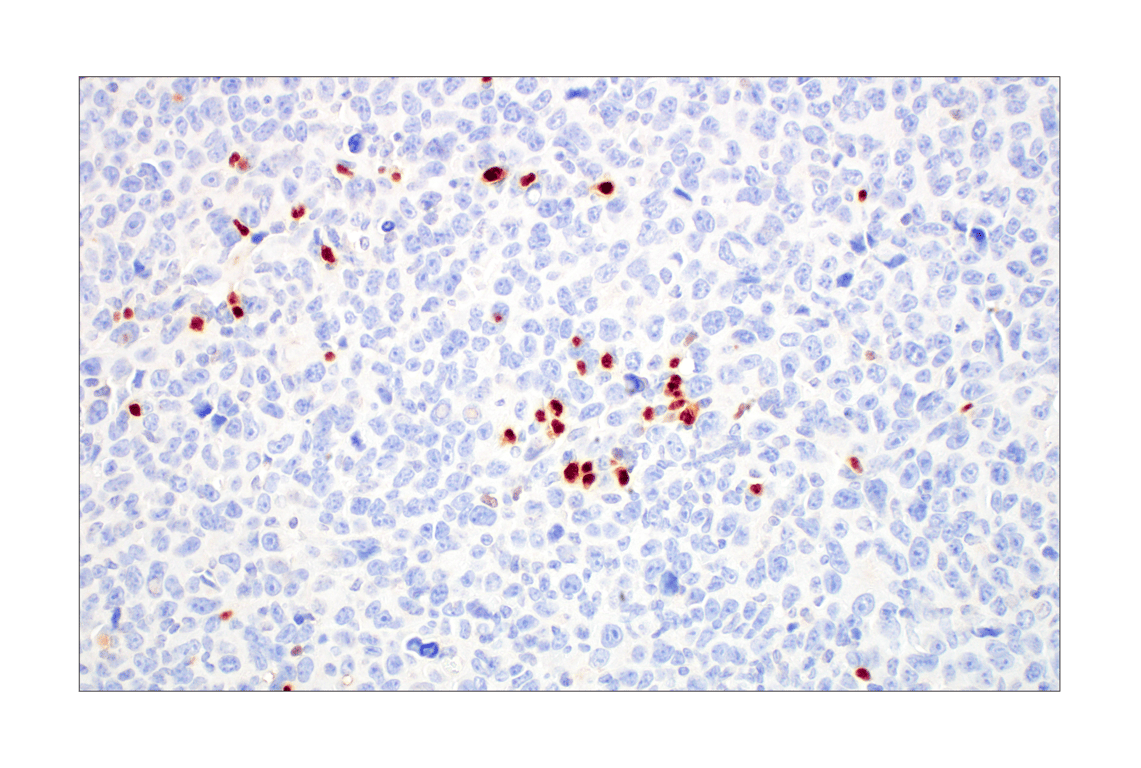 Immunohistochemistry Image 10: T-bet/TBX21 (E4I2K) Rabbit Monoclonal Antibody (BSA and Azide Free)