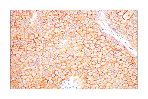 Immunohistochemistry Image 10: Phospho-Tyrosine Mouse Monoclonal Antibody (P-Tyr-100)