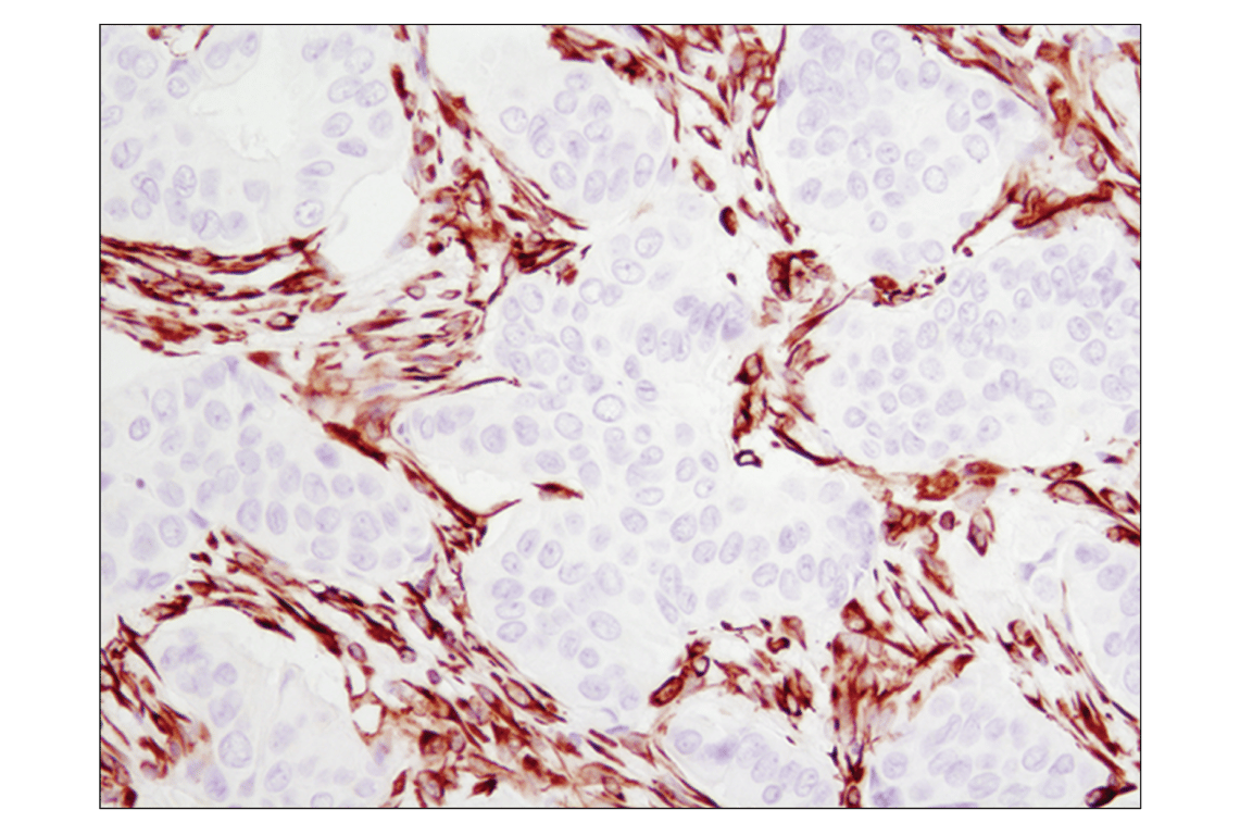 Immunohistochemistry Image 1: Vimentin (D21H3) Rabbit Monoclonal Antibody
