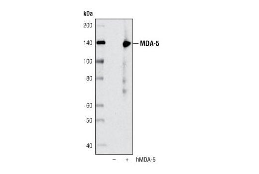 undefined Image 23: Rig-I Pathway Antibody Sampler Kit