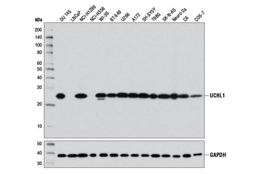 Western Blotting Image 2: UCHL1 (D3T2E) Rabbit Monoclonal Antibody (Biotinylated)