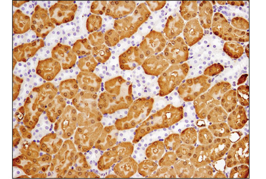 Immunohistochemistry Image 2: ASS1 (D4O4B) Rabbit Monoclonal Antibody
