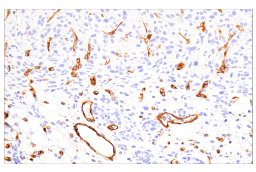 Immunohistochemistry Image 1: PLVAP (E4U6V) Rabbit Monoclonal Antibody