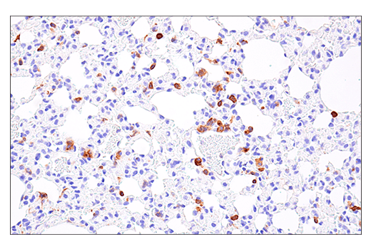 Immunohistochemistry Image 2: NK1.1/CD161 (E6Y9G) Rabbit Monoclonal Antibody
